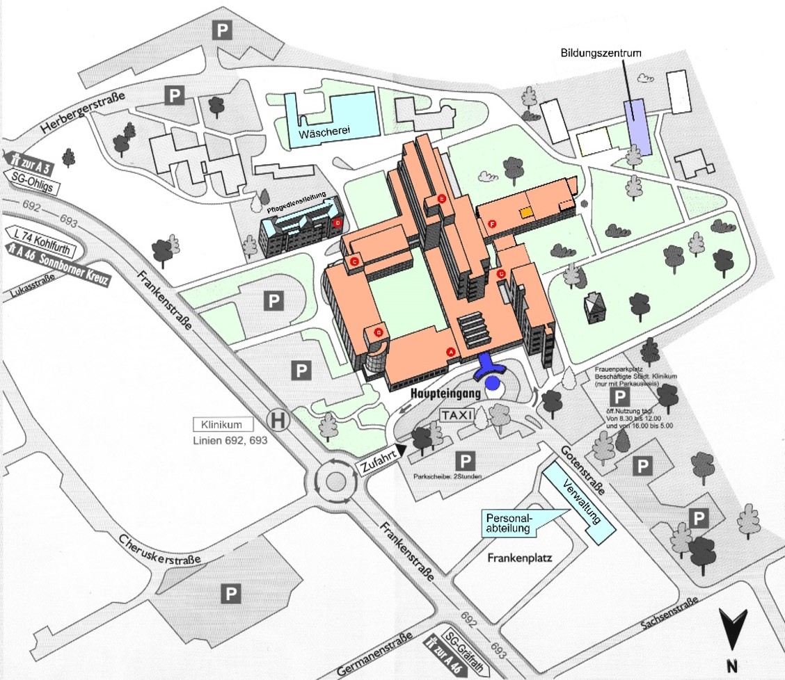 Übersichtsplan Klinikum Solingen